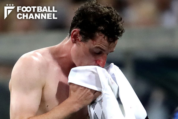 ドイツmf 相手スパイクが顔面直撃で大流血 鼻骨骨折で韓国戦出場微妙か ロシアw杯 フットボールチャンネル